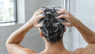 Ketoconazol shampoo bij haaruitval: helpt Nizoral? 6 vragen over roos, 1% of 2% en minoxidil